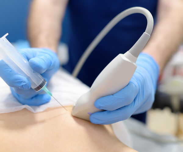 Biopsia escissionale del seno