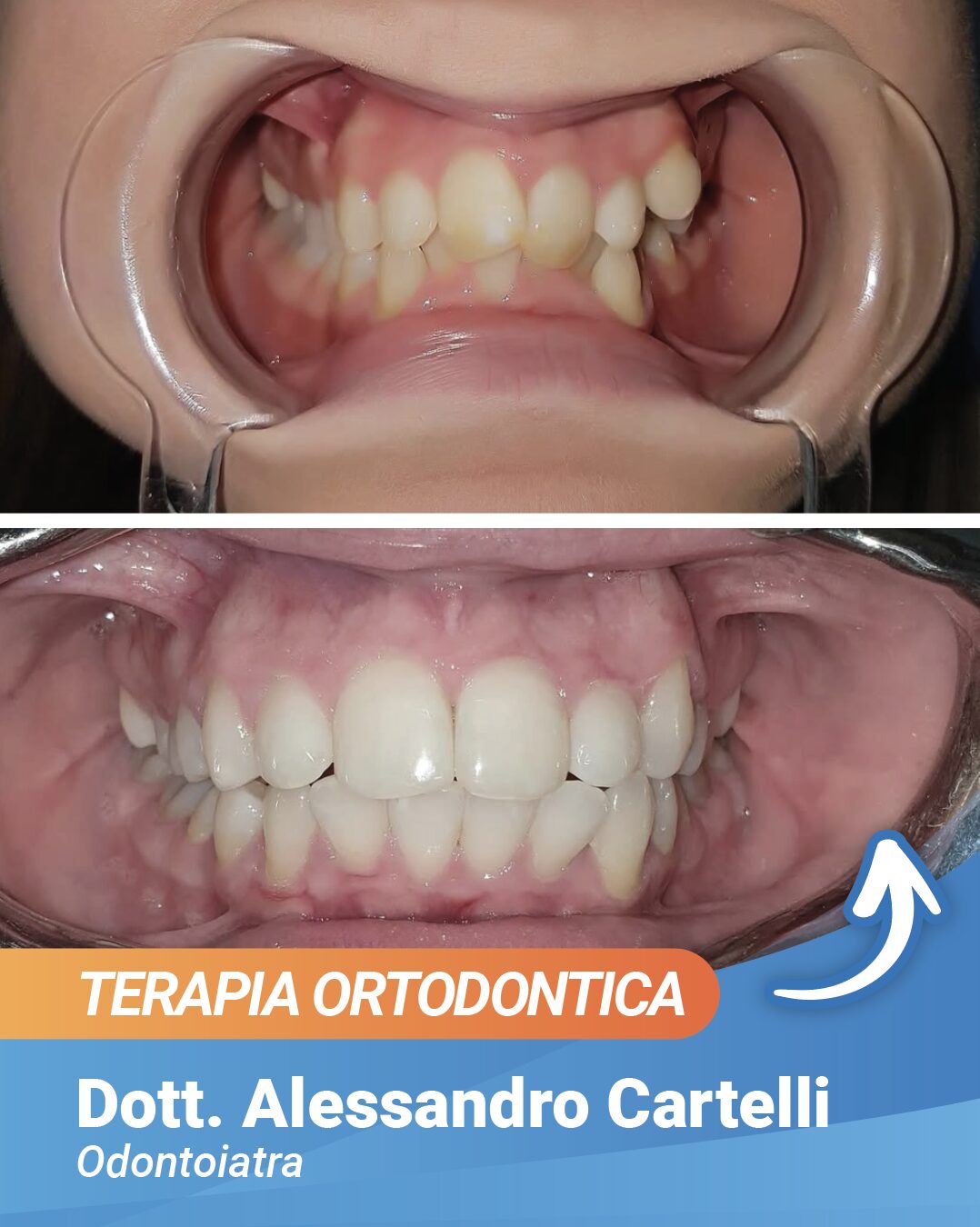 prima e dopo dott cartelli sunmed