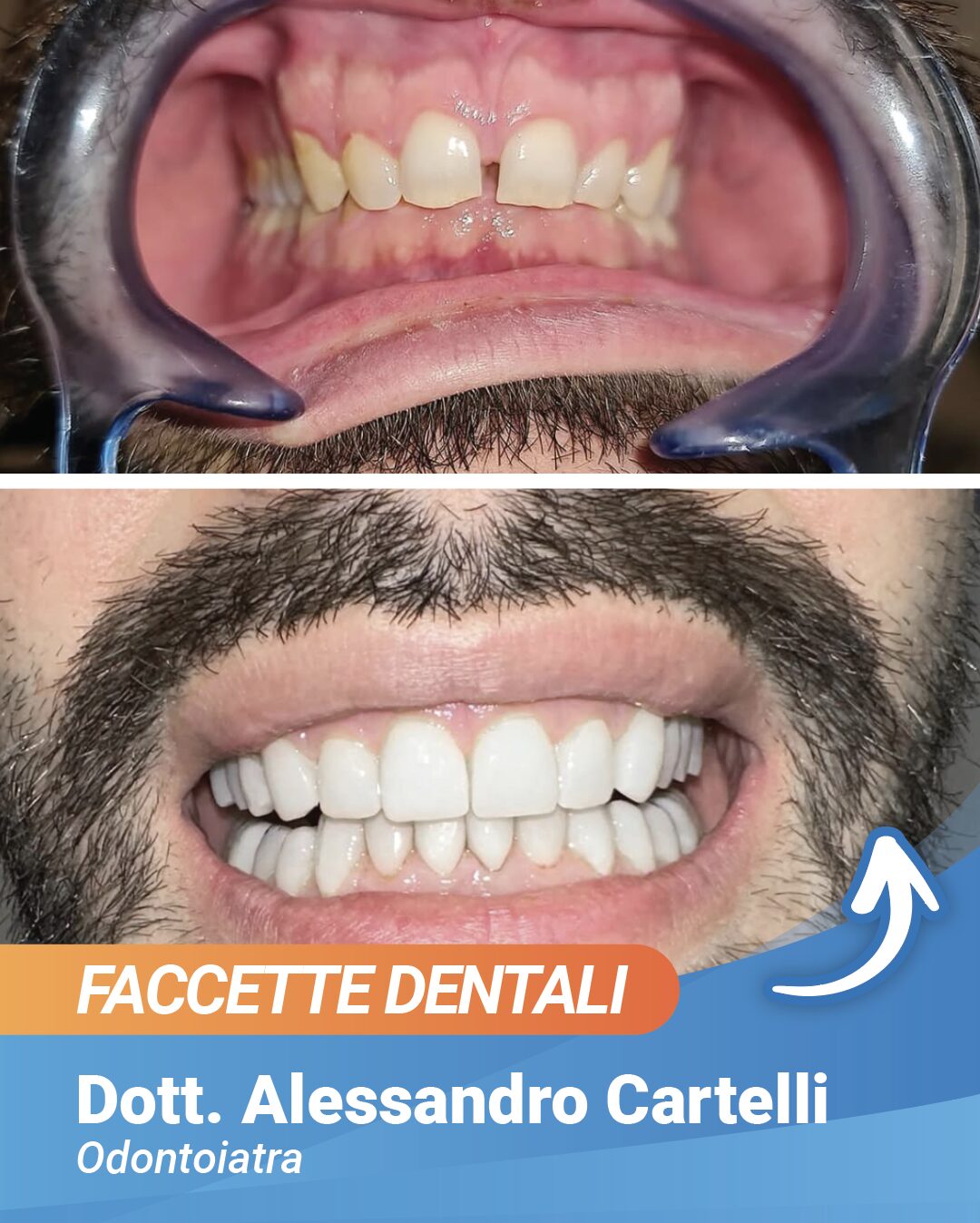 prima e dopo dott cartelli sunmed