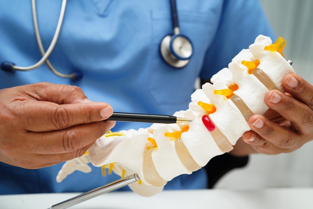 differenze tra Lombalgia Sciatalgia