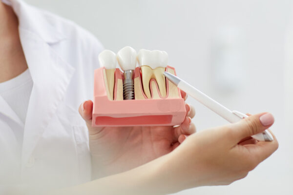 impianti-dentali-riassorbimento-osseo-soluzioni