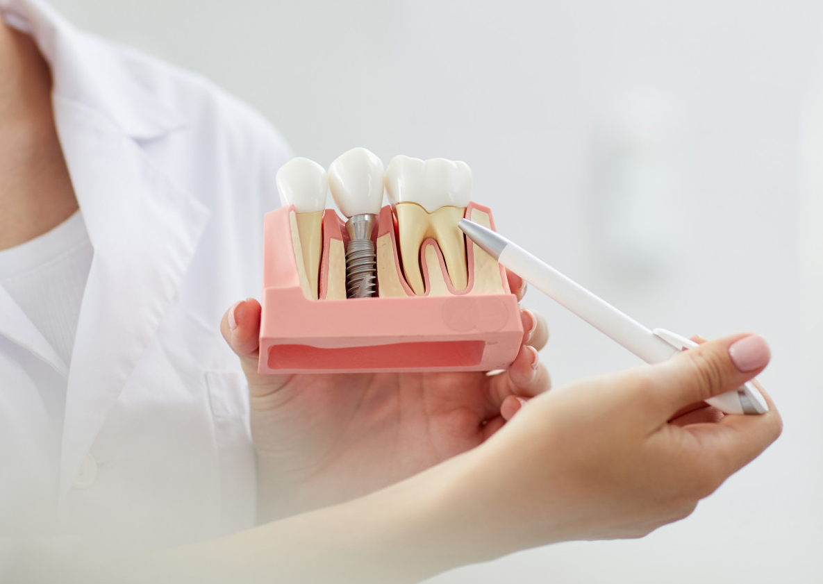 impianti-dentali-riassorbimento-osseo-soluzioni